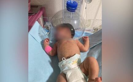 Por falta de insumos, ocupan botella de plástico para atender a bebé en hospital IMSS-Bienestar en Tabasco; suspenden a dos directivos