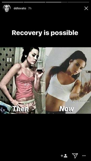 Mira cuánto ha cambiado Demi Lovato tras superar la bulimia