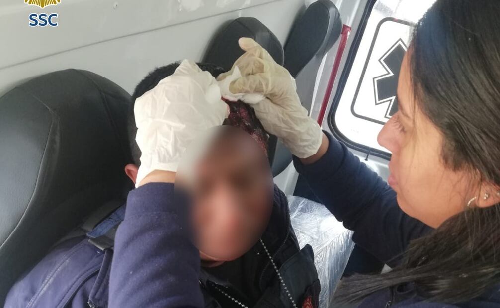 Un policía resultó herido (16/01/2025). Foto: Especial