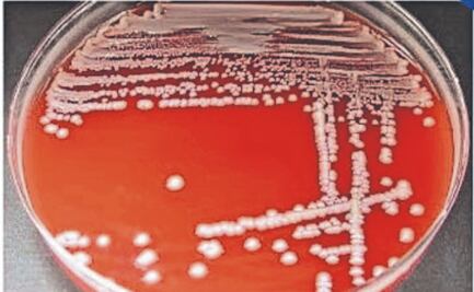 Lanzan alerta por bacteria intestinal Klebsiella oxytoca
