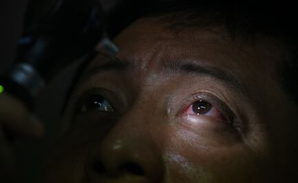 ¡A cuidarse los ojos!