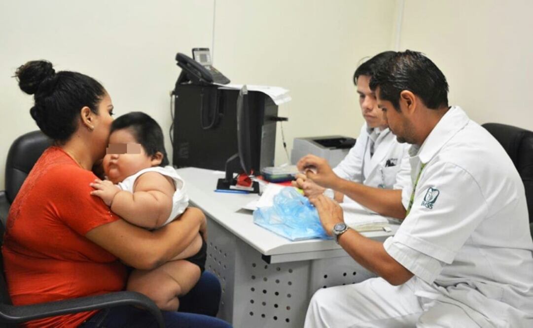 Especialistas del IMSS atienden sobrepeso de bebé de 28 kilos