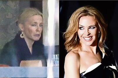 El extraño rostro de Kylie Minogue