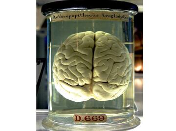 Enfermedades cerebrales ahora serán diagnosticadas con sonda y tecnología de luz