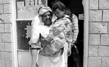 Mueren al menos 29 niños en ataque contra autobús en Yemen