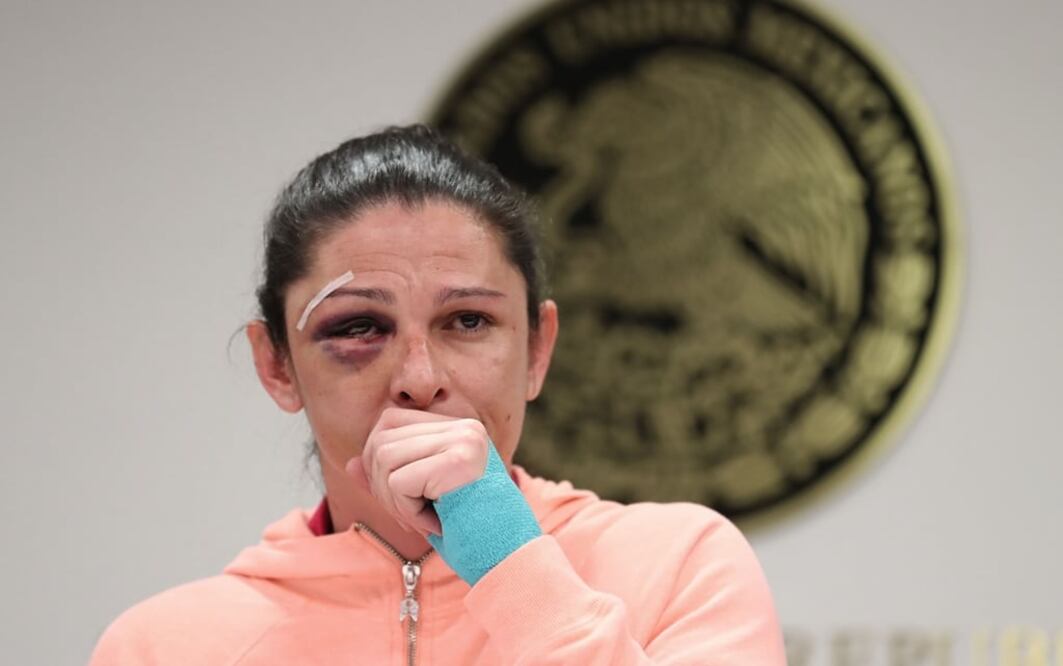 Guevara dijo que por traer puesto un casco no pudo ser identificada por los atacantes. Tampoco les dijo que ella es senadora de la república. Foto: Juan Carlos Reyes/EL UNIVERSAL