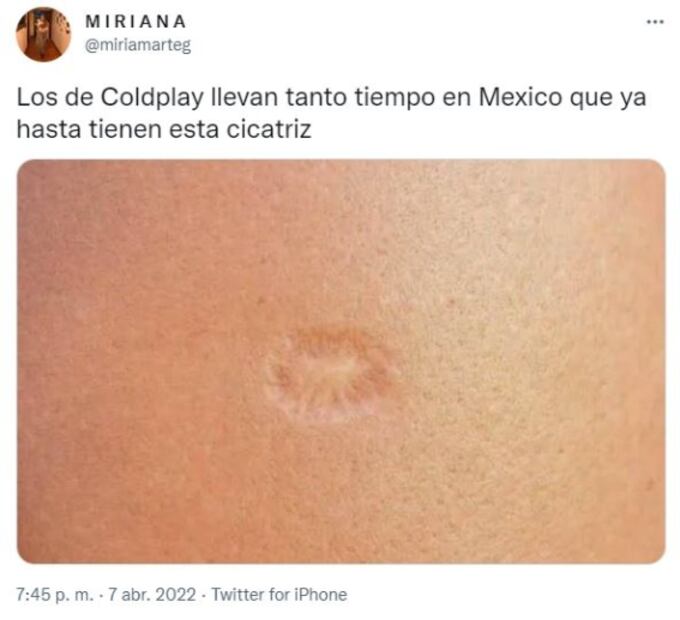 Los de Coldplay en México, el performance de Pepx Romero y la nueva pelea de Adame, en los memes de la semana