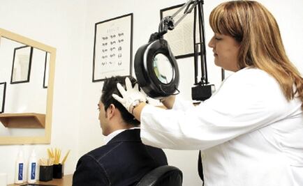 Los tipos de calvicie que se presenta en hombres y mujeres