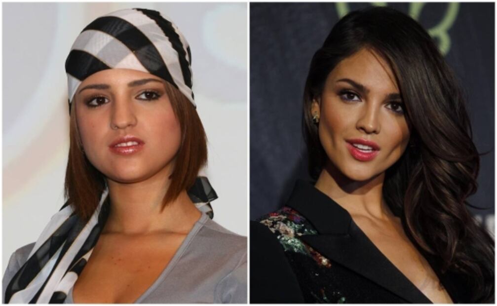 Así ha cambiado el rostro de estas famosas después de las cirugías y el bótox 