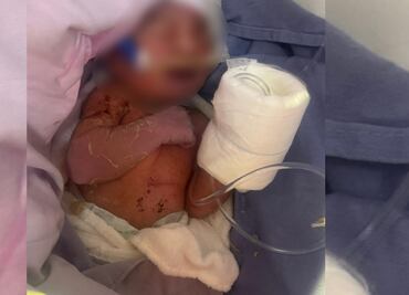 Rescatan a bebé recién nacida abandonada en calles de Ciudad Azteca; estaba en una bolsa de basura