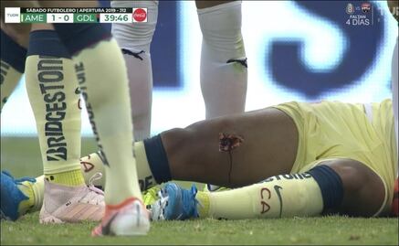Escalofriante lesión de Giovani dos Santos durante el Clásico