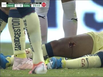 Escalofriante lesión de Giovani dos Santos durante el Clásico