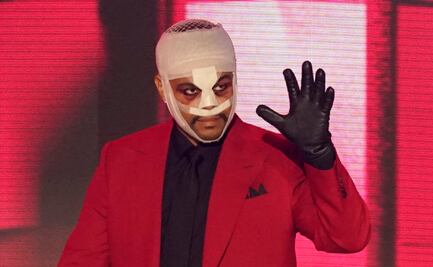 ¿Por qué The Weeknd llegó vendado a los American Music Awards?