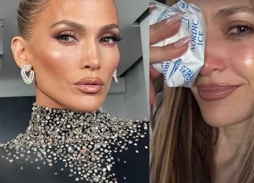 Jennifer Lopez se lastima el rostro en ensayo de los American Music Awards 2025; muestra el resultado en redes