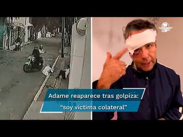 “Soy víctima colateral”: Alfredo Adame; reaparece luego de ser golpeado