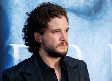 Kit Harington hizo casting de "Game of Thrones" con el ojo morado