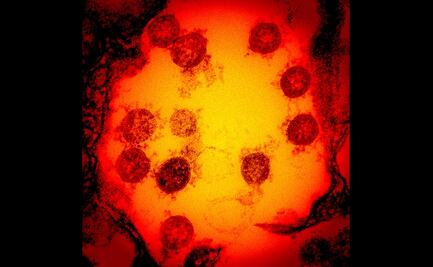 Identifican una proteína como posible responsable de la gravedad del Covid-19