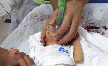 Grupo opositor niega haber lanzado ataque químico en Siria