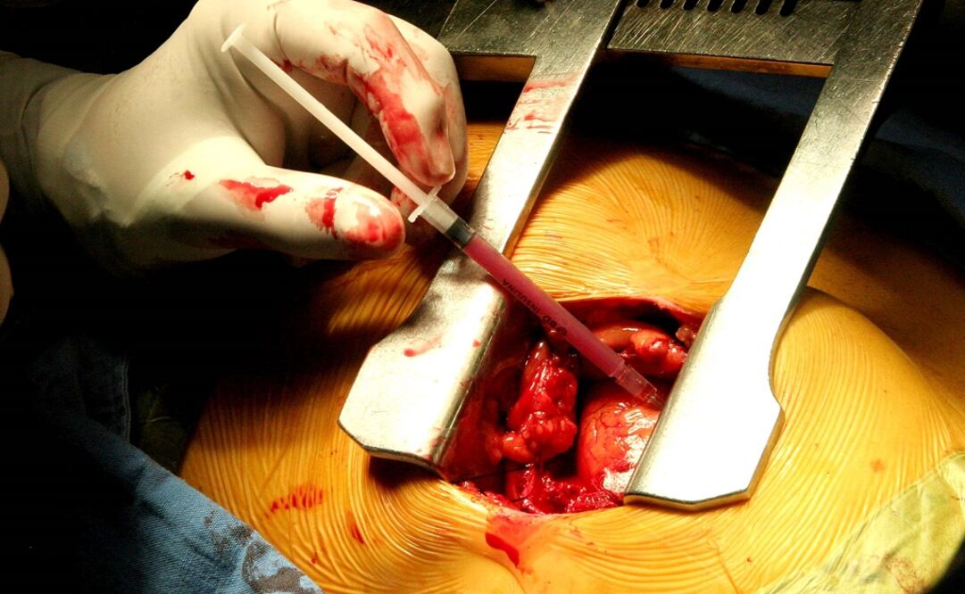 Foto: Archivo El Universal