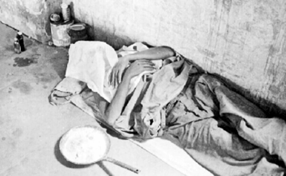 Foto de un convaleciente de lepra en 1955. “Nos encontramos leprosos en todas partes”, comentó un capitalino en agosto de 1930; aunque ya existían leprosarios y se mantenía un control en el número de contagios, algunos pobladores se vieron abrumados por los “lazarinos”, al grado de lapidarlos o asesinarlos por temor a su presencia. Foto: Mediateca INAH.