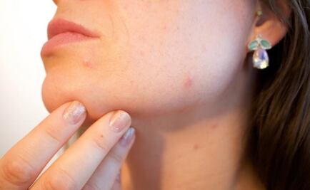 La inflamación "entrena" a la piel para sanar más rápido, según un estudio