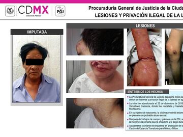 Abuela le causa deformidades y heridas graves a su nieta por maltrato