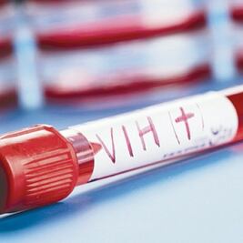 Indetectable, VIH en pacientes con trasplante de células madre