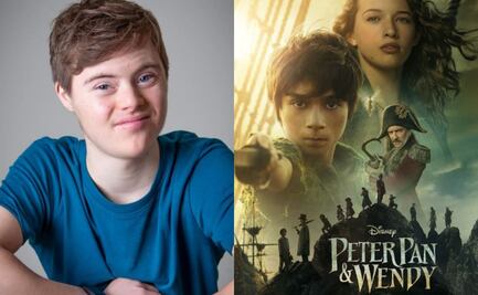 Actor con síndrome de down protagoniza live action de “Peter Pan & Wendy” de Disney