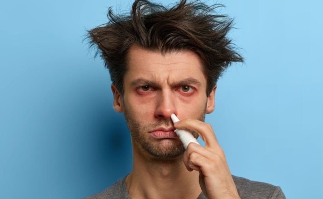 La mayoría de las sinusitis desaparecen solas y no requieren antibióticos. Fuente: Freepik.