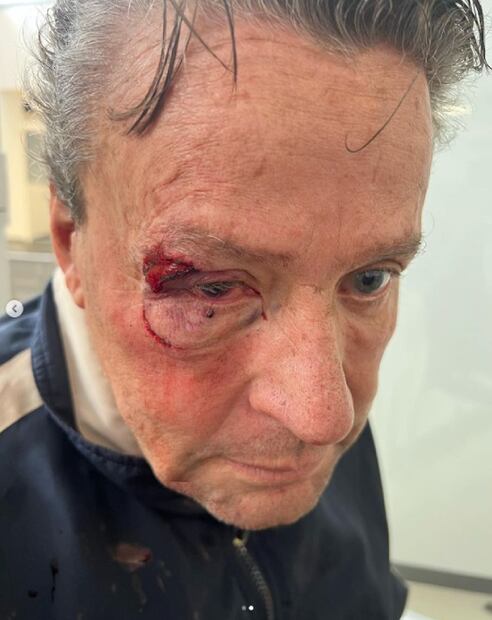 Golpean a Alfredo Adame por intentar grabar a dos personas baleadas en Tlalpan; hay dos detenidos