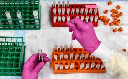 El Covid-19 es menos agresivo si tienes sangre tipo O