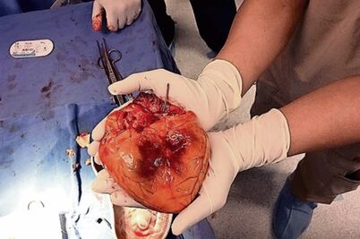 Van por donación de órganos automática