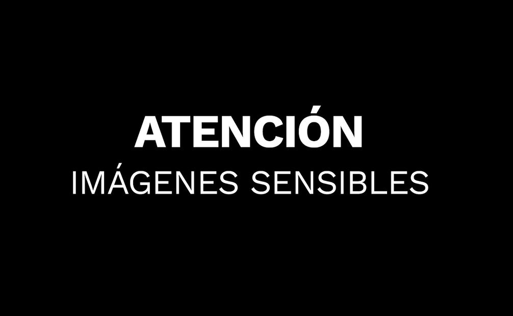 Imágenes sensibles