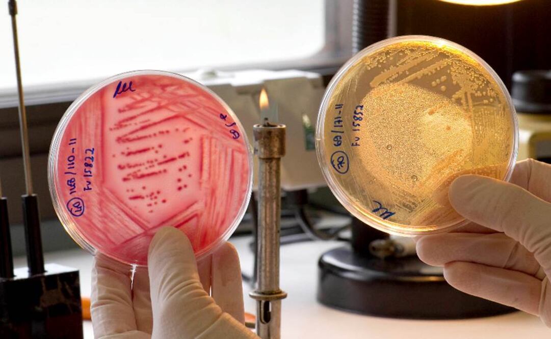 Programaron bacterias indicadores de la presencia de metástasis hepática (tipo de cáncer de hígado) en la orina. Foto: Archivo EL UNIVERSA