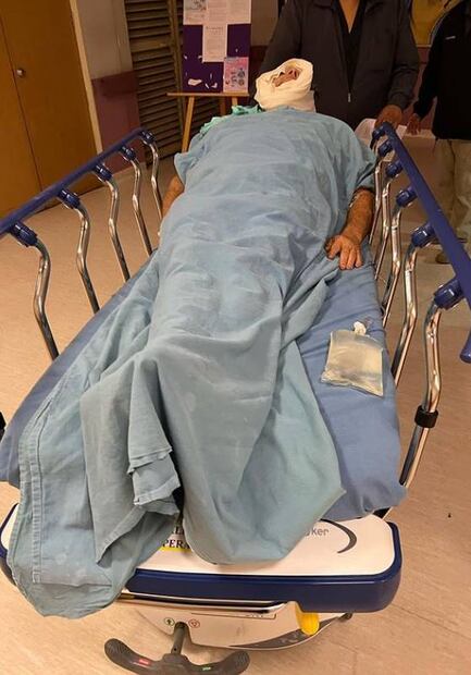 FOTOS: Así quedó Alfredo Adame tras cirugía: "Con un paracetamol quedo", dice