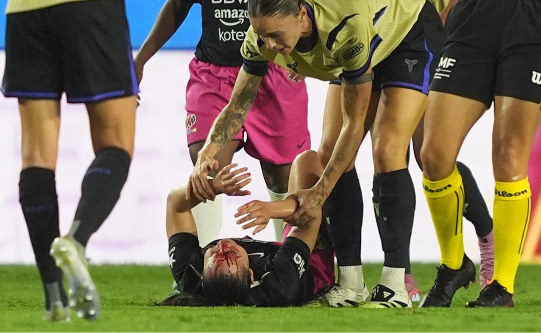 Charlyn Corral sufre escalofriante herida en Duelo de Estrellas vs Barcelona / Foto: Imago7