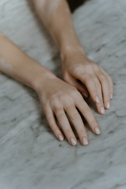 Los problemas más comunes en las uñas y cómo solucionarlos