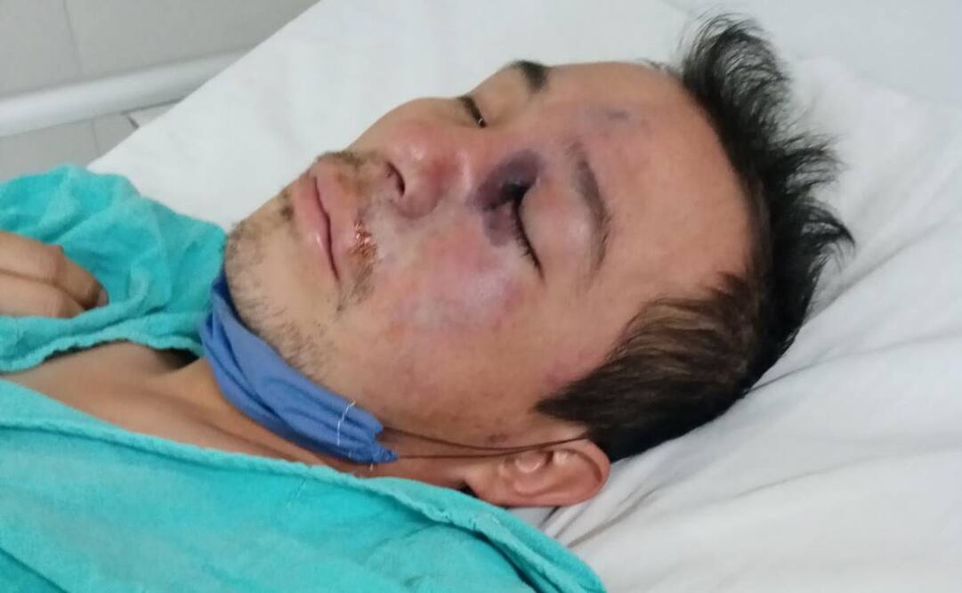 Gregorio Avendaño Jiménez, el paciente sospechoso de haber contraído una infección de "hongo negro", se encuentra hospitalizado en el "La Raza". Foto: Especial 
