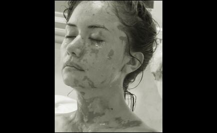 Luego de 8 años, detienen a mujer que agredió con ácido a Leslie en Pachuca