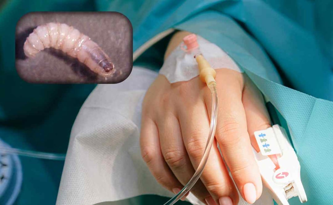 Hositalización de personas infectadas por miasis a causa del gusano barrenador / Foto: Pexels