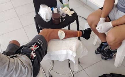 Migrante cubano enfermo por gusano barrenador pide ayuda a Sheinbaum; busca permiso para llegar a CDMX