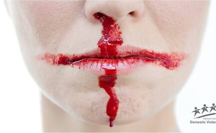 Violencia doméstica crece con derrota de Inglaterra