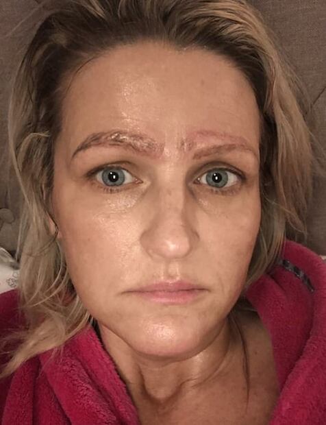 Mujer se hace microblading y le dibujan cuatro cejas