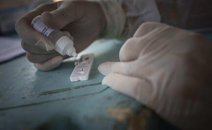 Sheinbaum alerta por ineficacia de pruebas serológicas para Covid en Álvaro Obregón