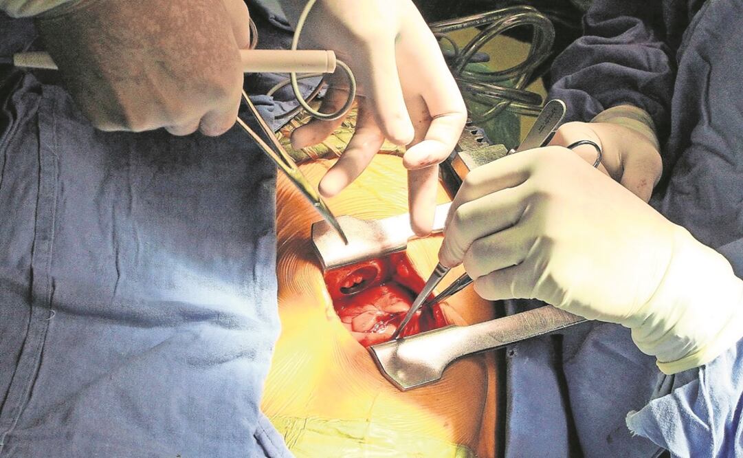 Imagen ilustrativa. Foto: Archivo 