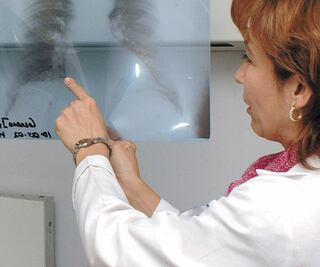 Prevé la OMS más muertes por EPOC