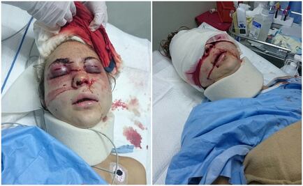 Tras golpiza, nieta de Cantinflas deberá ratificar demanda