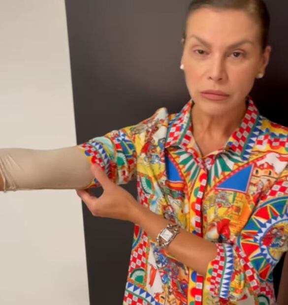 Así luce la cantante Olga Tañón tras someterse a una cirugía estética