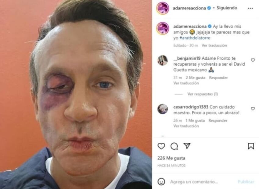 "Te pareces más que yo", le dice Alfredo Adame a Arath de la Torre por parodia