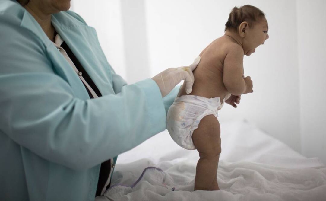 Confirman relación entre zika y defectos de nacimiento